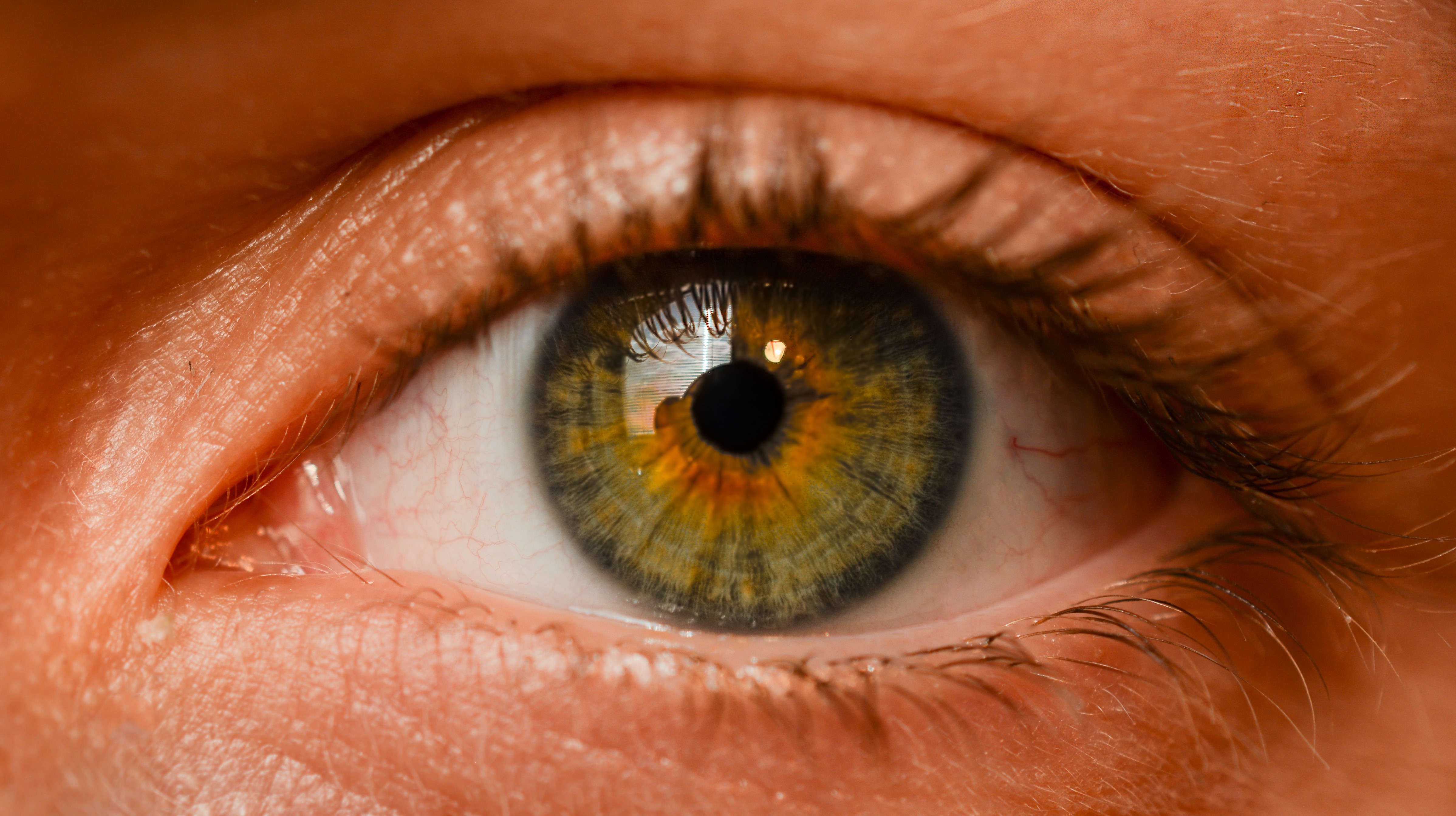 Photo d'iris, bilan de vitalité, iridologie, naturopathe rennes