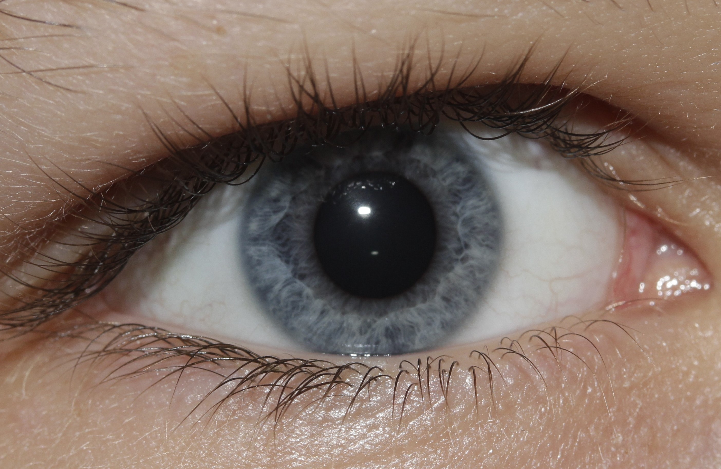 Photo d'iris, bilan de vitalité, iridologie, naturopathe rennes